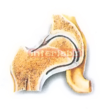 HUMAN HIP JOINT (CORONAL SECTION) MODEL